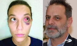 Ozan Güven’e sevgilisine şiddetten hapis cezası: Abajur silah sayıldı
