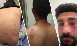 Mersin’de sekiz kişilik aile, Kürtçe konuştukları için saldırıya uğradı