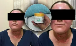 Van’da sahte krem skandalı: 19 yaşındaki genç kadının yüzü yandı