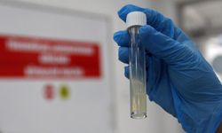 Dünyanın en ölümcül bulaşıcı hastalığı geçen yıl 1 milyon can aldı