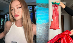 Beşinci kalça ameliyatı: Danla Bilic, vücudundan çıkan dolguyu paylaştı