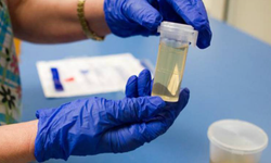 Saç boyamak, idrar sulandırmak, tırnak kesmek: Uyuşturucu testlerini "kandırmak" mümkün mü?