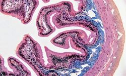 Dışkı transferiyle bağırsaktaki kök hücreler yenilendi