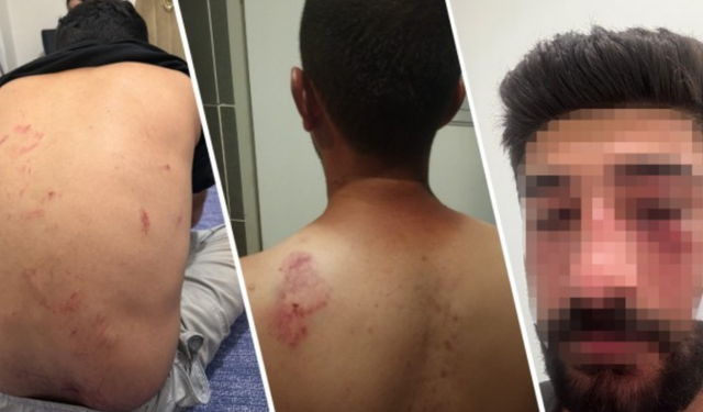 Mersin’de sekiz kişilik aile, Kürtçe konuştukları için saldırıya uğradı