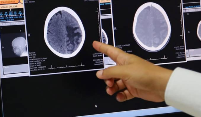 Araştırma: Beyin en yüksek kapasitesine gençlikte değil, olgunlukta ulaşıyor