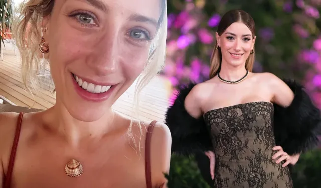 Diş estetiği alay konusu olmuştu: Söktürüp yeniden yaptırdı