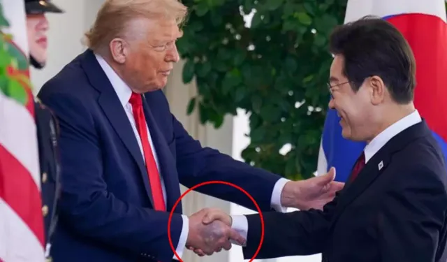 Donald Trump elindeki morlukların nedenini açıkladı