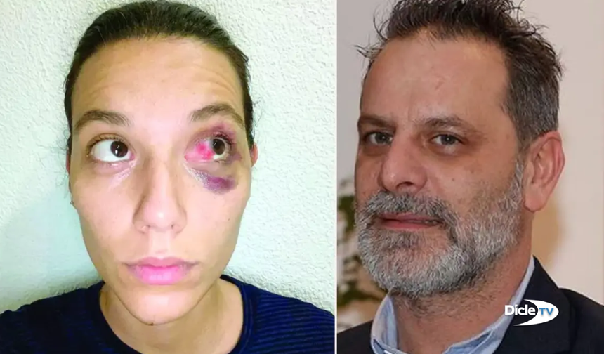 Ozan Güven’e sevgilisine şiddetten hapis cezası: Abajur silah sayıldı