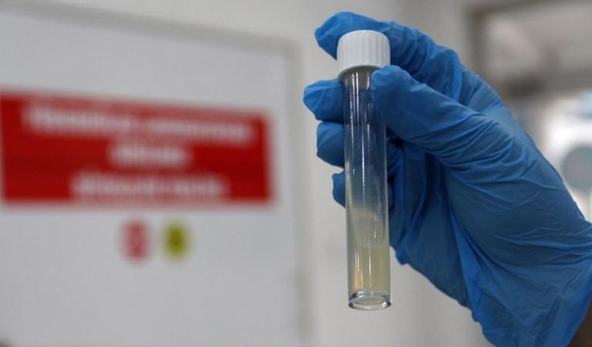 Dünyanın en ölümcül bulaşıcı hastalığı geçen yıl 1 milyon can aldı